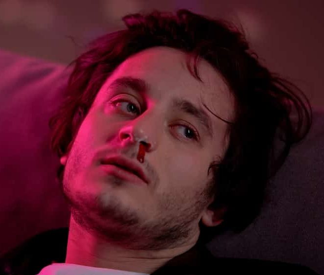Disheveled man suffering from signs of cocaine addiction with bloody nose staring away with neon light shining on one side of face