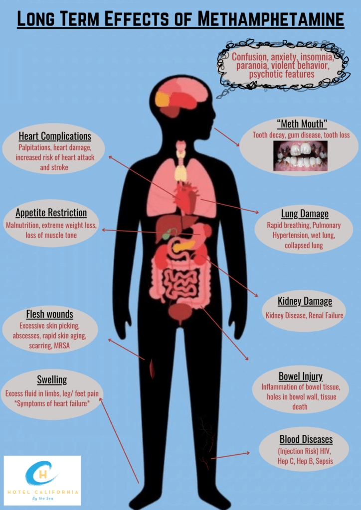 Infographic showing the long term effects of methamphetamine.