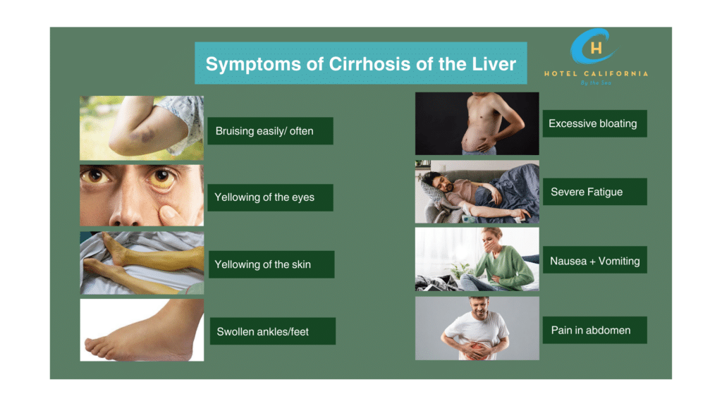 Infographic showing the symptoms of Cirrhosis in the liver due from alcohol abuse.
