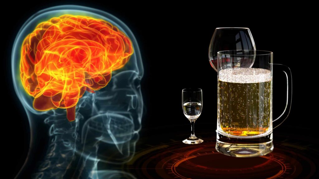 A virtual image of the human brain is next to a large glass of alcoholic beer and wine represents the effect of wet brain.