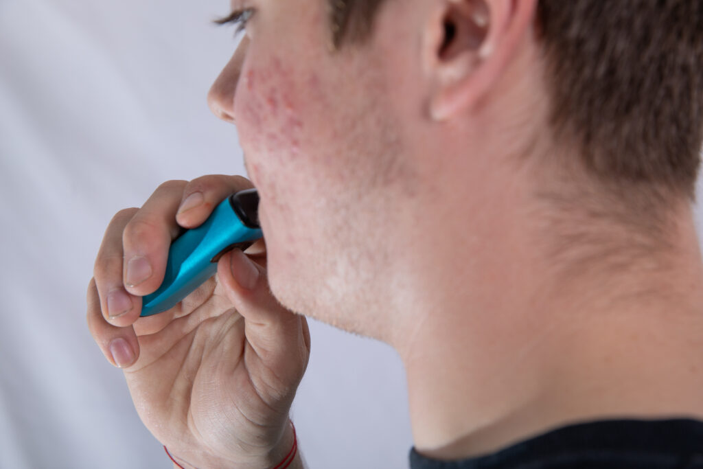 A young man with acne using a vaping device shows there may be a correlation between vaping and acne.