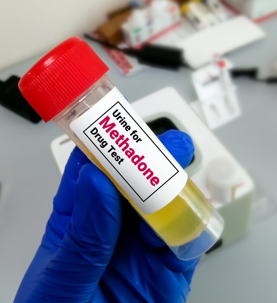 A urine drug test tub can be used as part of methadone detox to determine if the drug has left a persons system.
