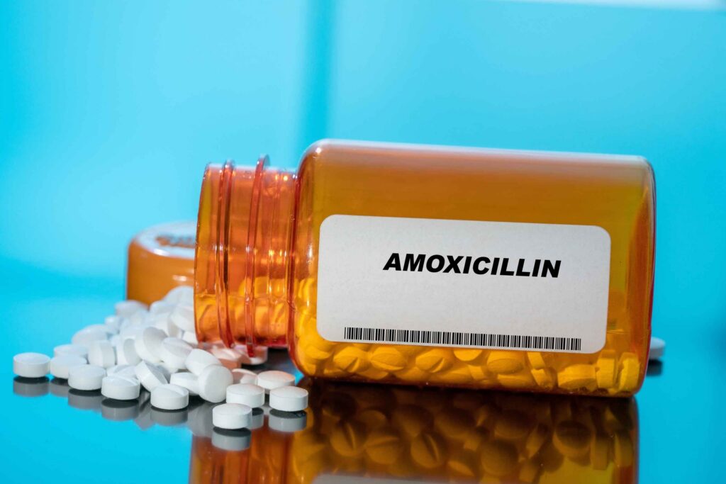 An orange pharmacy bottle of amoxicillin is spilled over representing if it is safe to take alcohol and amoxicillin antibiotics at the same time.