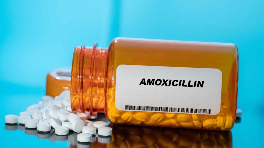 An orange pharmacy bottle of amoxicillin is spilled over representing if it is safe to take alcohol and amoxicillin antibiotics at the same time.